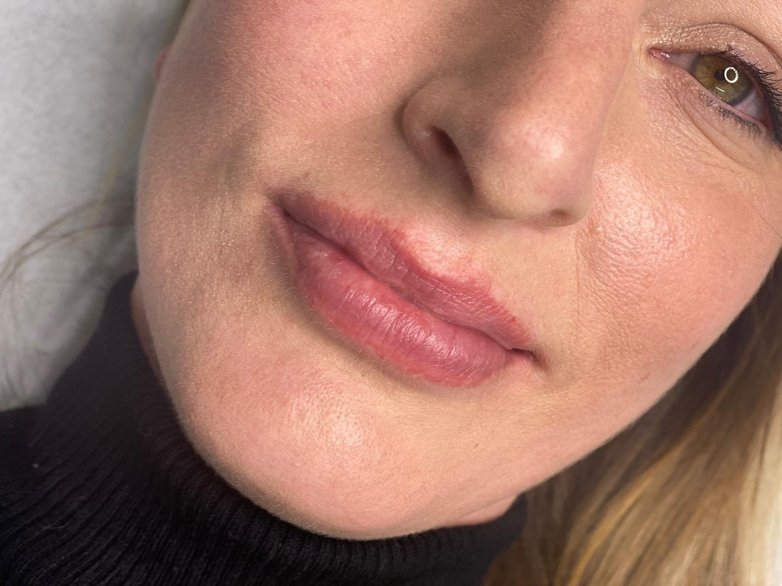 Lips before lip blush at Brows By Jo
