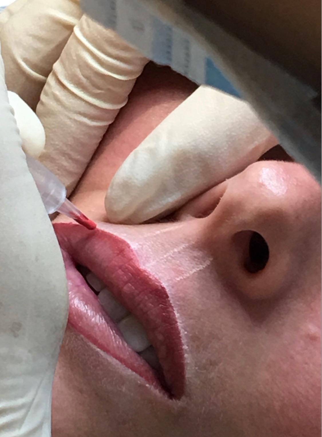 Lip blush treatment in progress at Brows By Jo