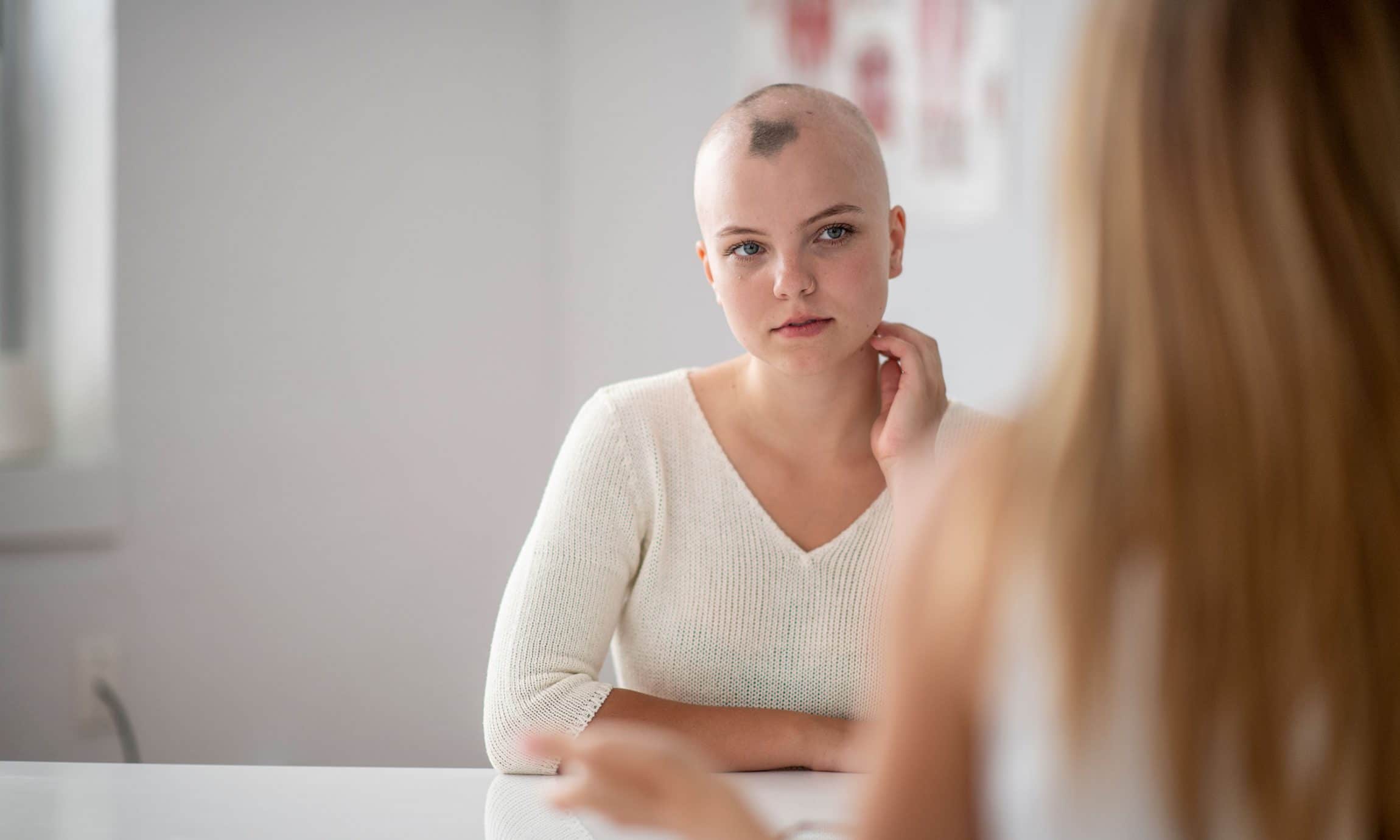 smp for alopecia banbury