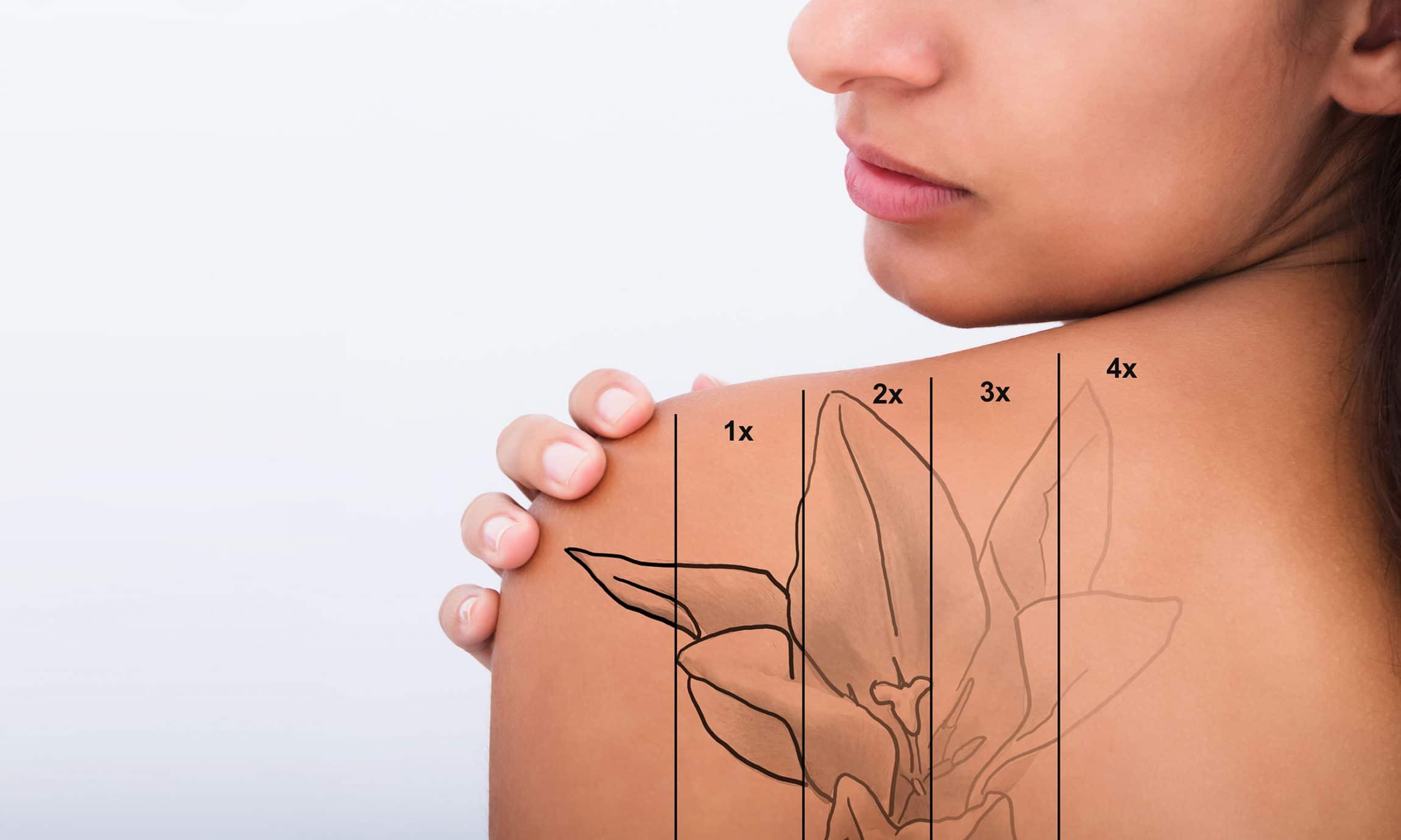 tattoo removal in banbury at brows by jo
